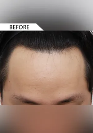 Before