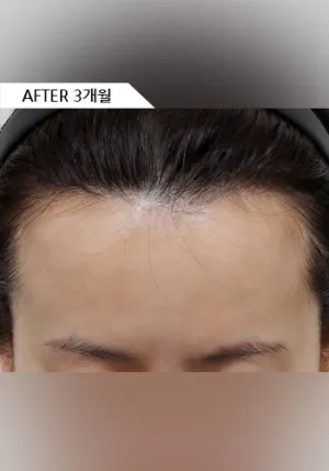 After