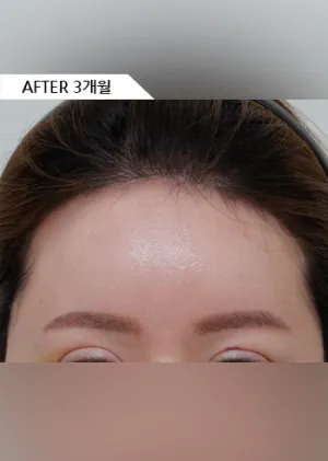 After