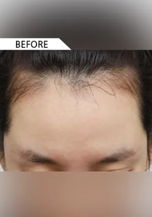 Before