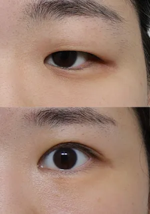 After