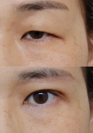After
