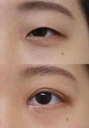 After
