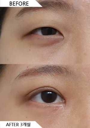 Before