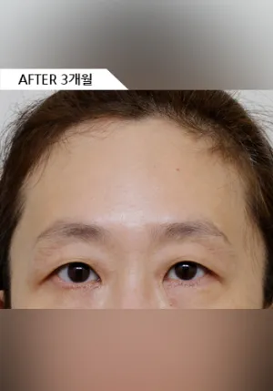After