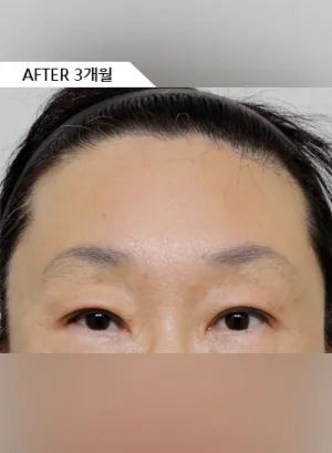 After