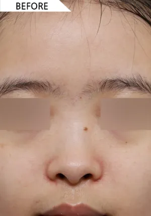 Before