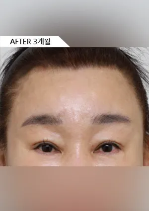 After