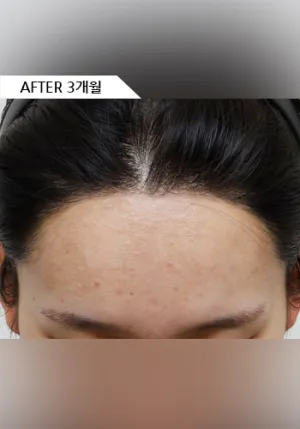 After