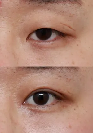 After