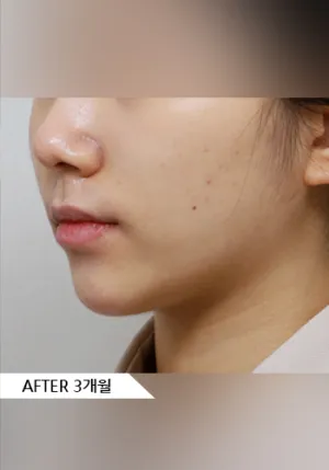 After