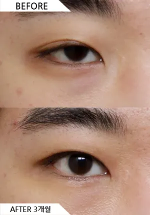Before