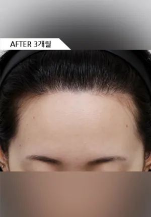 After
