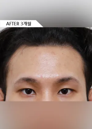 After