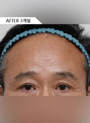 After