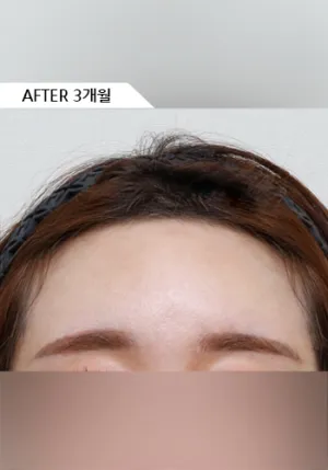 After