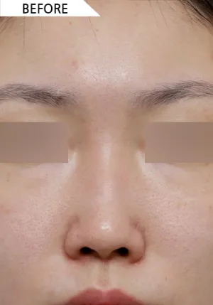 Before
