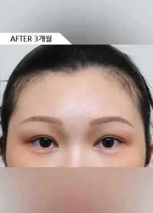 After