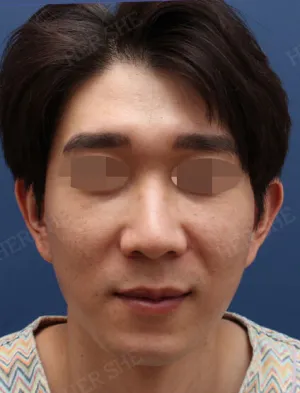 Before