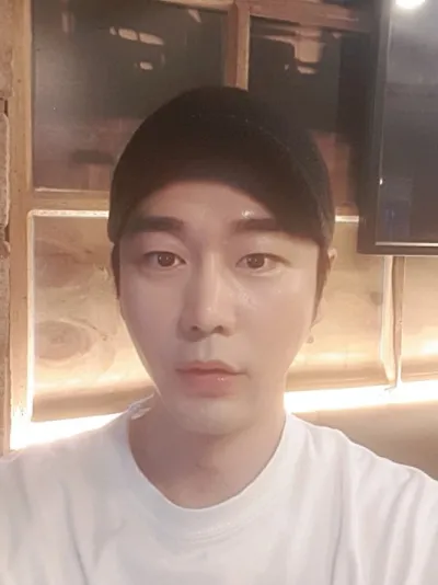 糸リフティングと額脂肪移植を受けました〜