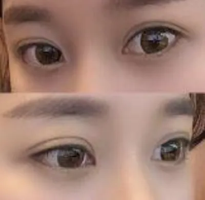 [目] 花見に行こうかな - 目つき矯正