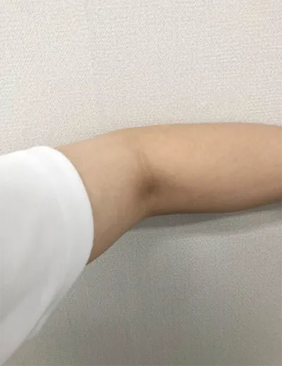 [쁘띠] 暑いけど - 腕