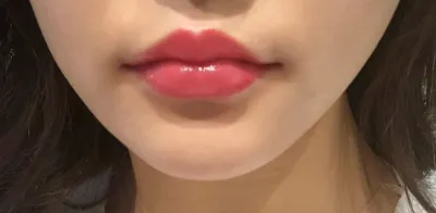 [プチ] アモーミ - フィラー