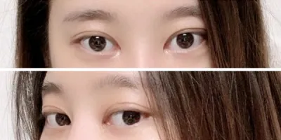 [目] ドゥチス - 目