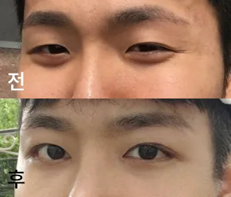 [目] チルニオ - 目