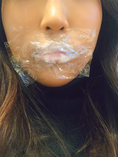 [プチ] hyb - 唇フィラー、ボトックス