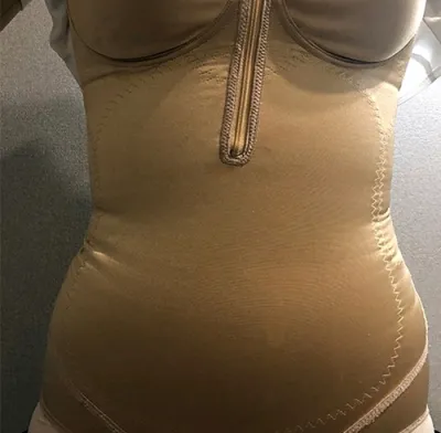 [脂肪吸引] 星のように飛んでいこう - 腹部、ふくらはぎの脂肪吸引