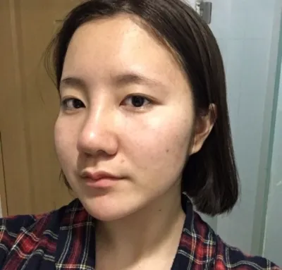 [鼻] イーワンダー - 鼻