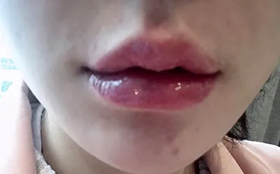 [プチ] オルチュンチョ - 唇