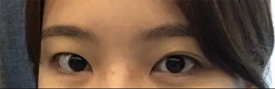 [目] ドリドリa - 目