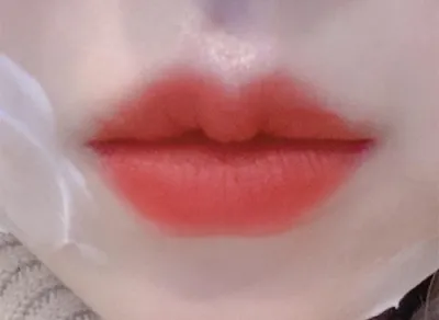 [プチ] hunnie8894 - 唇フィラー