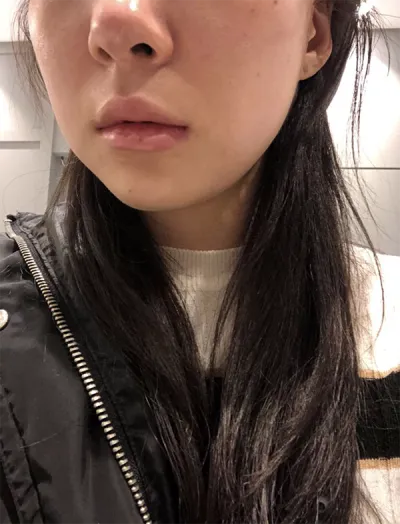 [皮膚] ハナハヌン - シュリンク