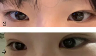 [目] チョキ1234 - 目