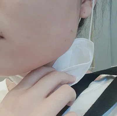 [プチ] seoul - 顎ボトックス