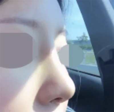 [鼻] ggggghhhhhhhh - 鼻