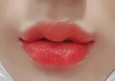 [プチ] ダヒイン - フィラー