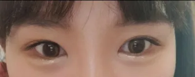 [目] ジンフィリウス - 目