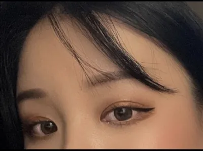 [目] 骨切り効果 - 目頭切開