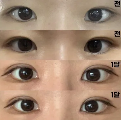 心配していたのとは違って変化がはっきりと見えて満足しています!