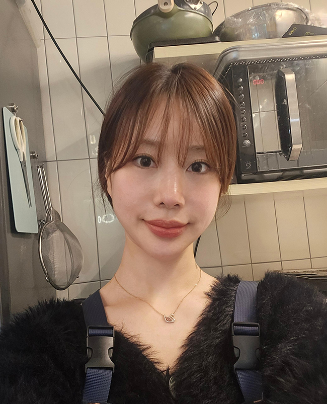 휜코 교정, 재수술! 너무 만족해요