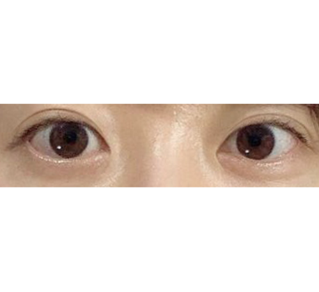 目つき矯正、すごく自然だね！