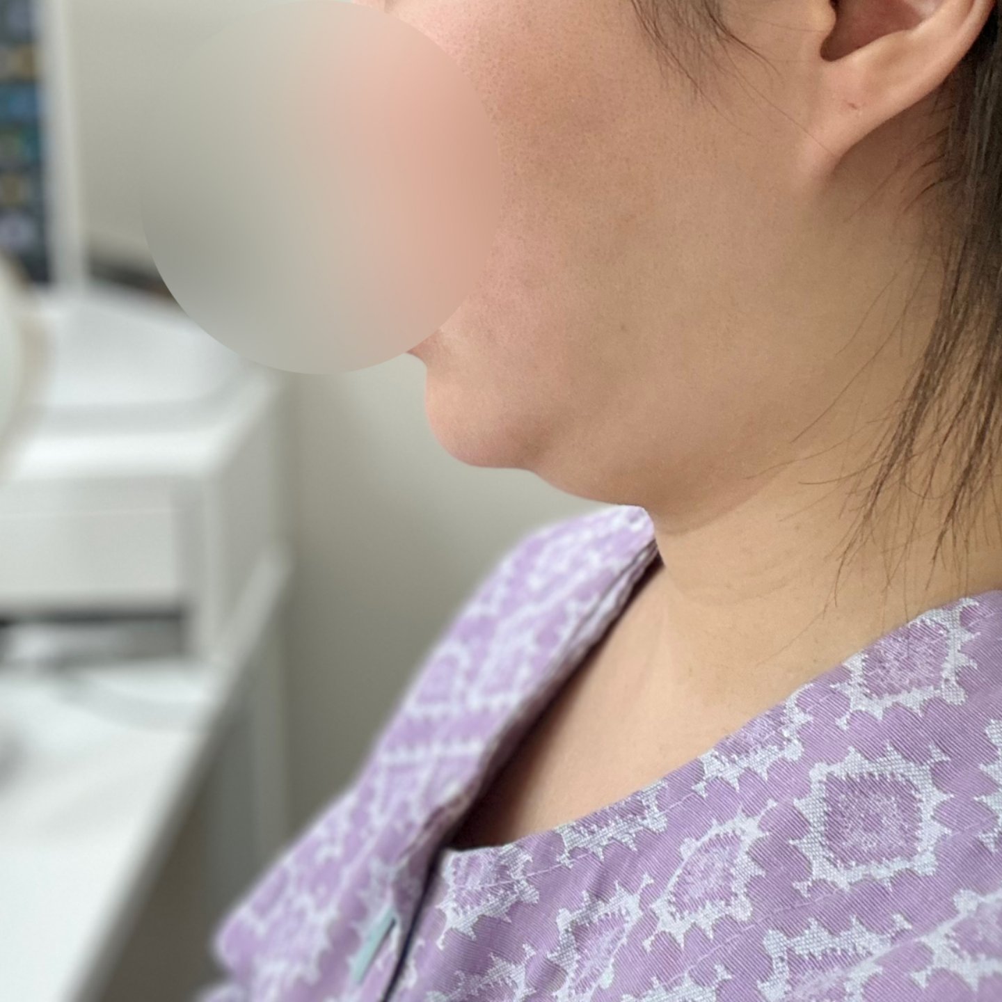 날렵한 옆턱선으로 아주아주 베리굿이에요