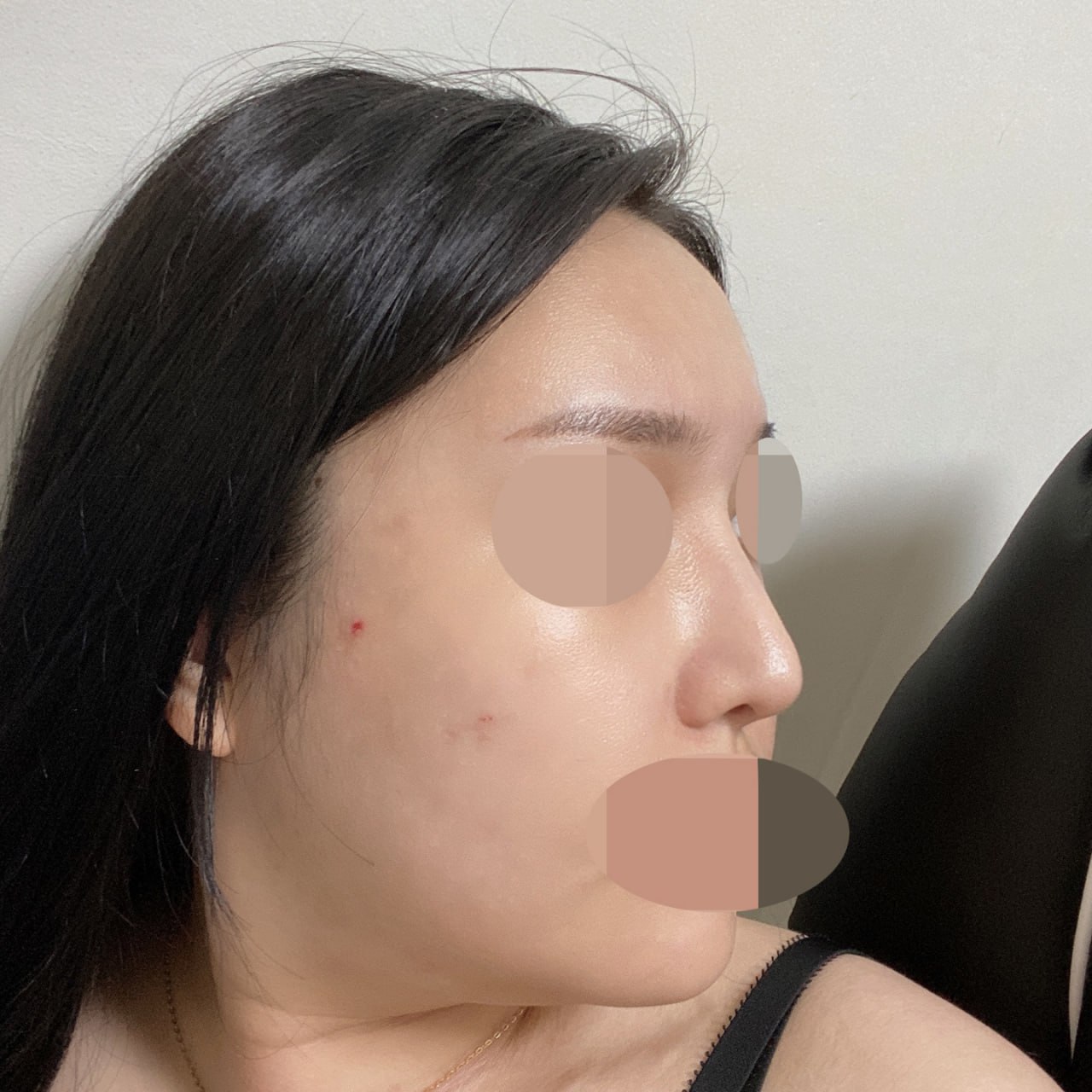 처음 부목 땠을때 라인 그대로 유지 짱짱해요