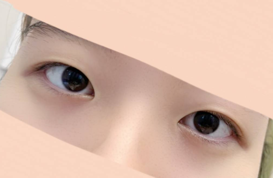 확실히 쌍수한 눈이 세련되 보여서 좋아요