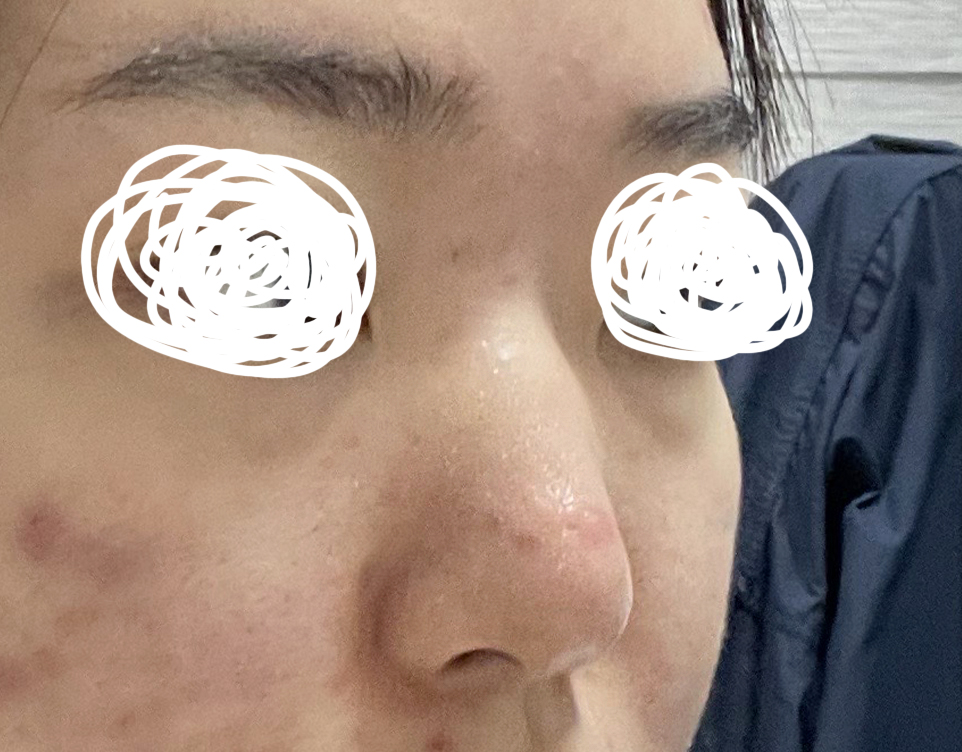 결과는 대만족 제가 들고 간 사진 그대로 복사 붙여넣기 해주셨어요 ㅠㅜ