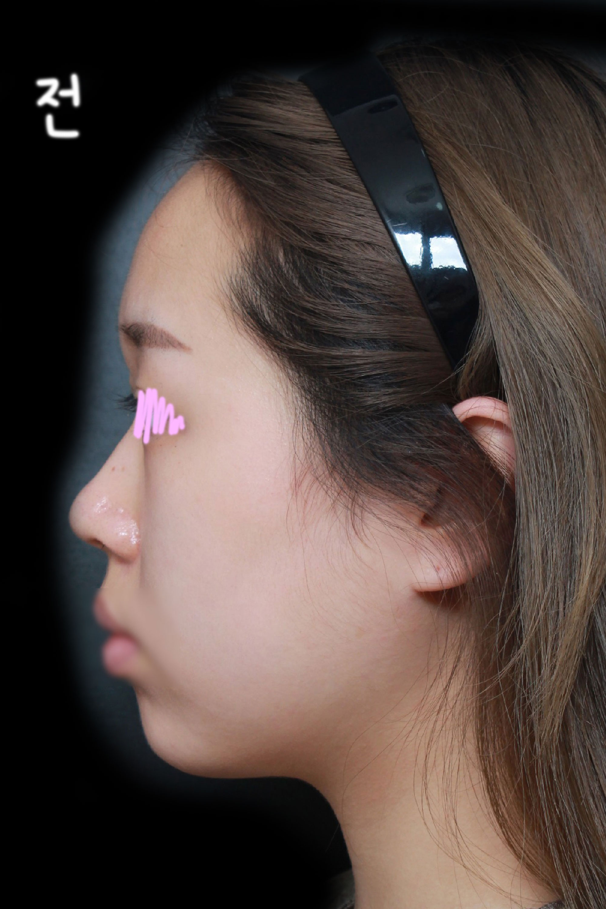 다들 병원 어디냐고 물어요 ㅎㅎ 감사합니다 ❤